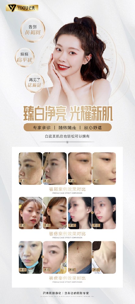 已秀专业瘦身怎么合作